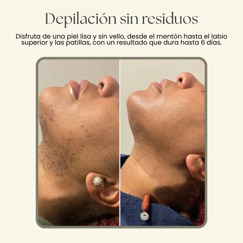 Crema Depilatoria Facial Nuvelia & Sérum Calmante
